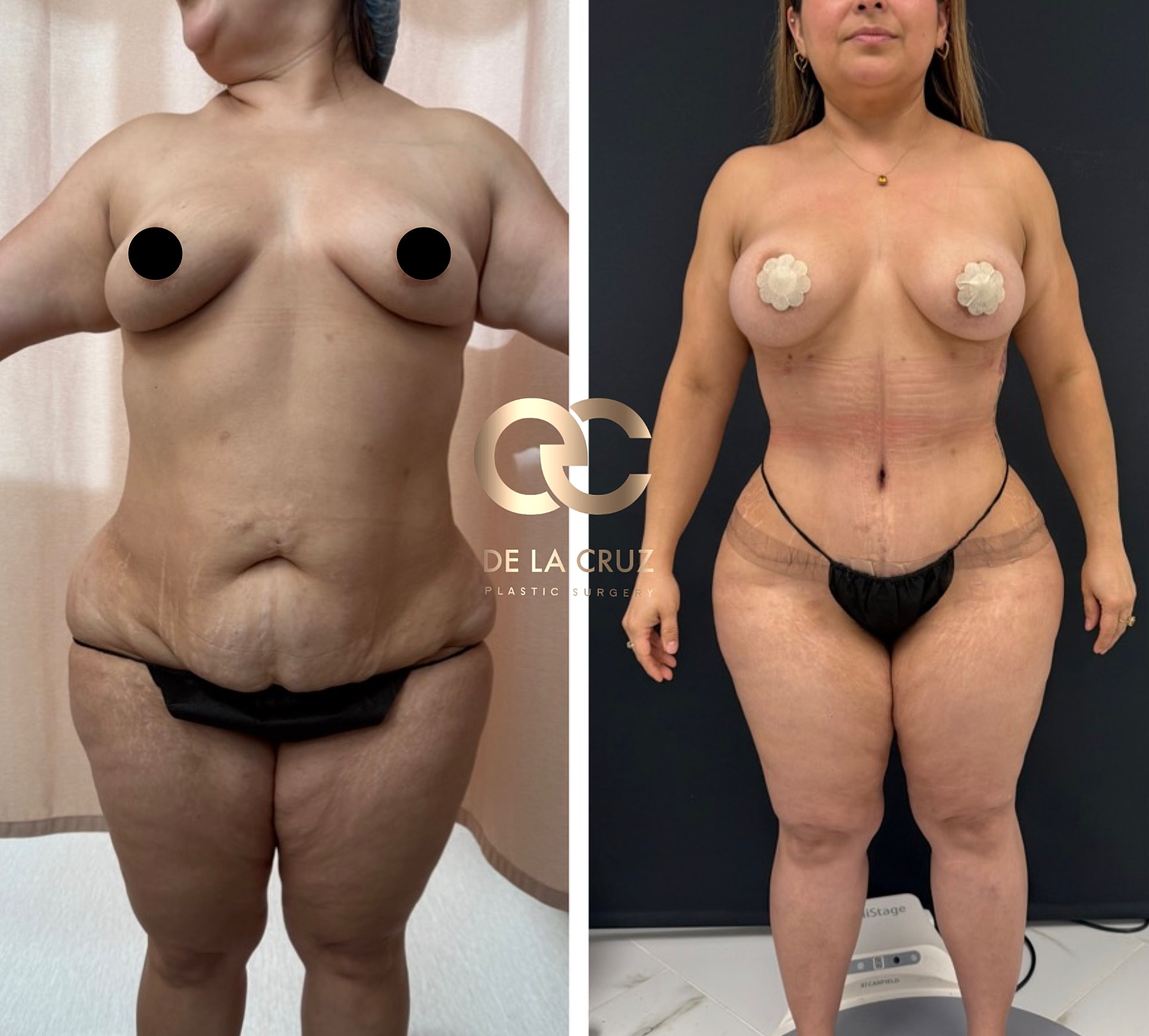 Before and after plastic surgery transformation photos.