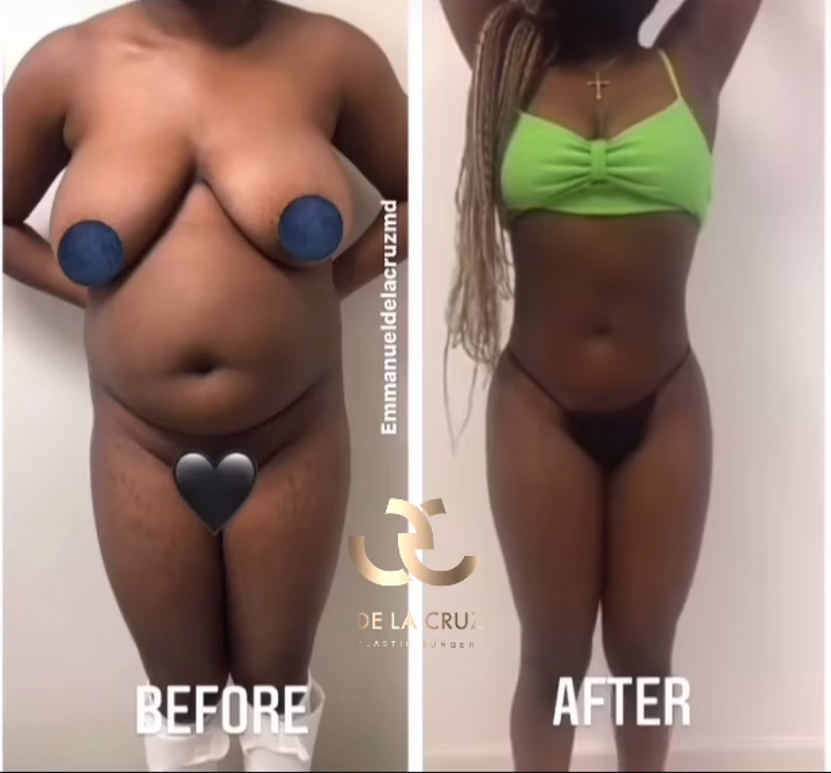 Before and after body transformation photo.
