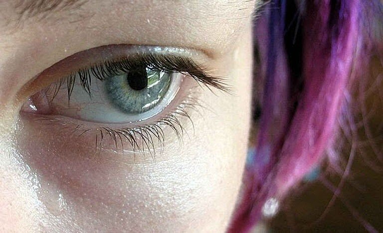 Lagophthalmos: An Eyelid Surgery Complication