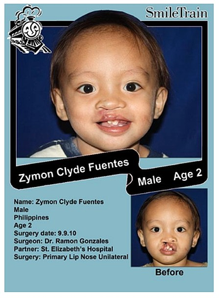 Let's help support SMILE TRAIN