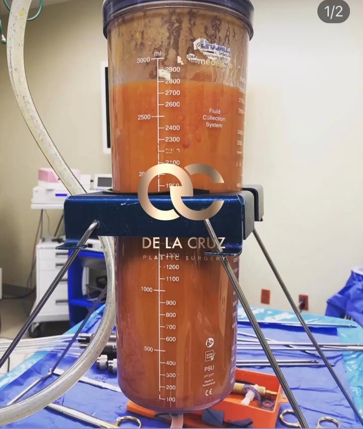 liposuction fat aspirate Dr. Emmanuel De La Cruz