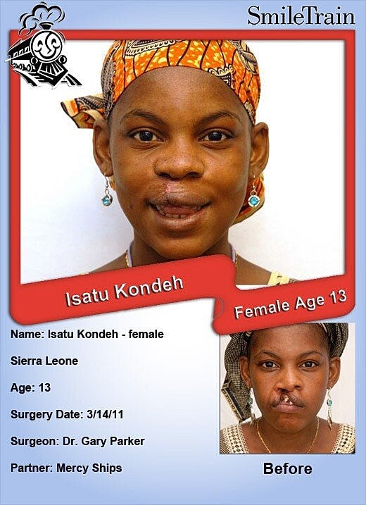 Smile Train May 2011: Sierra Leone