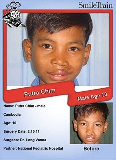 Smile Train of the Week ~ Cambodia