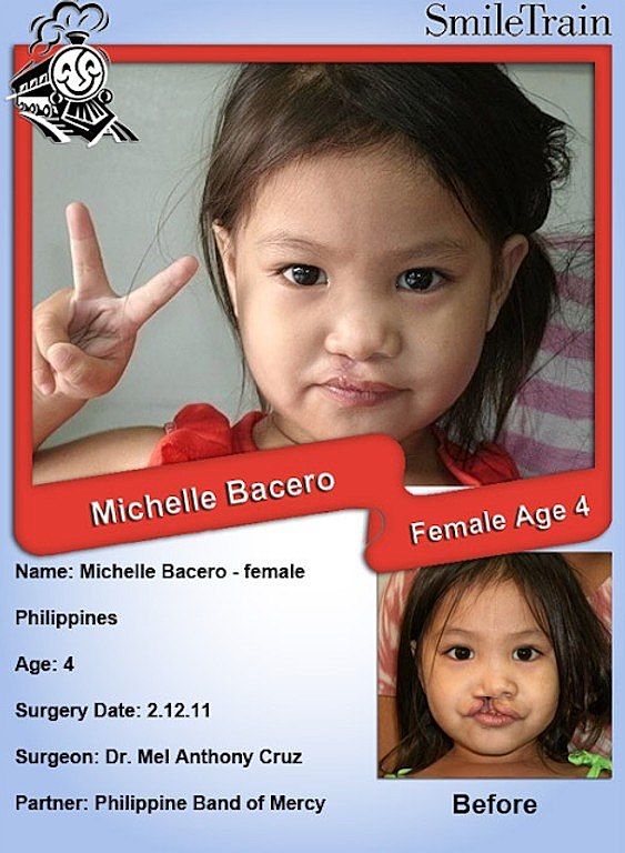 Smile Train of the Week ~ Philippines