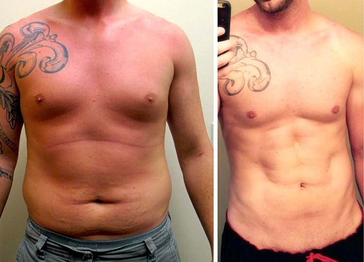 Before and after body transformation comparison.
