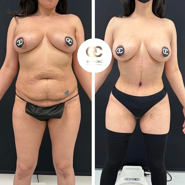 Before and after body transformation image.
