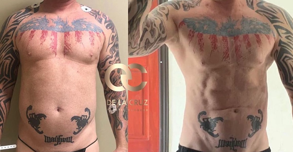 Body transformation with tattoos and muscle definition.
