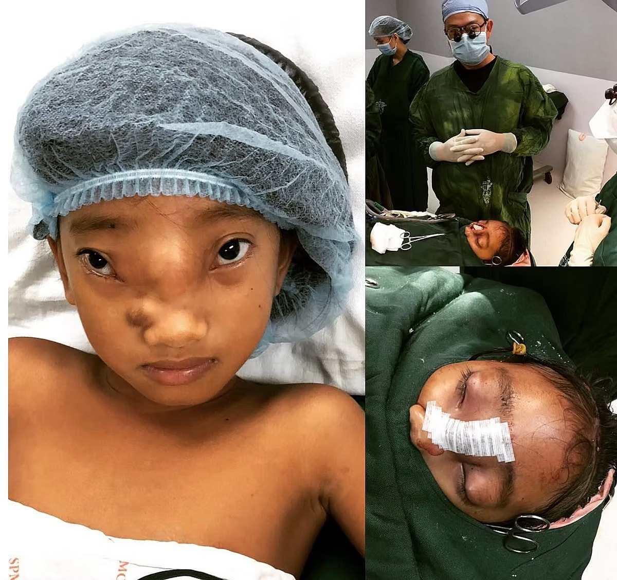 best plastic surgeon houston de la cruz.