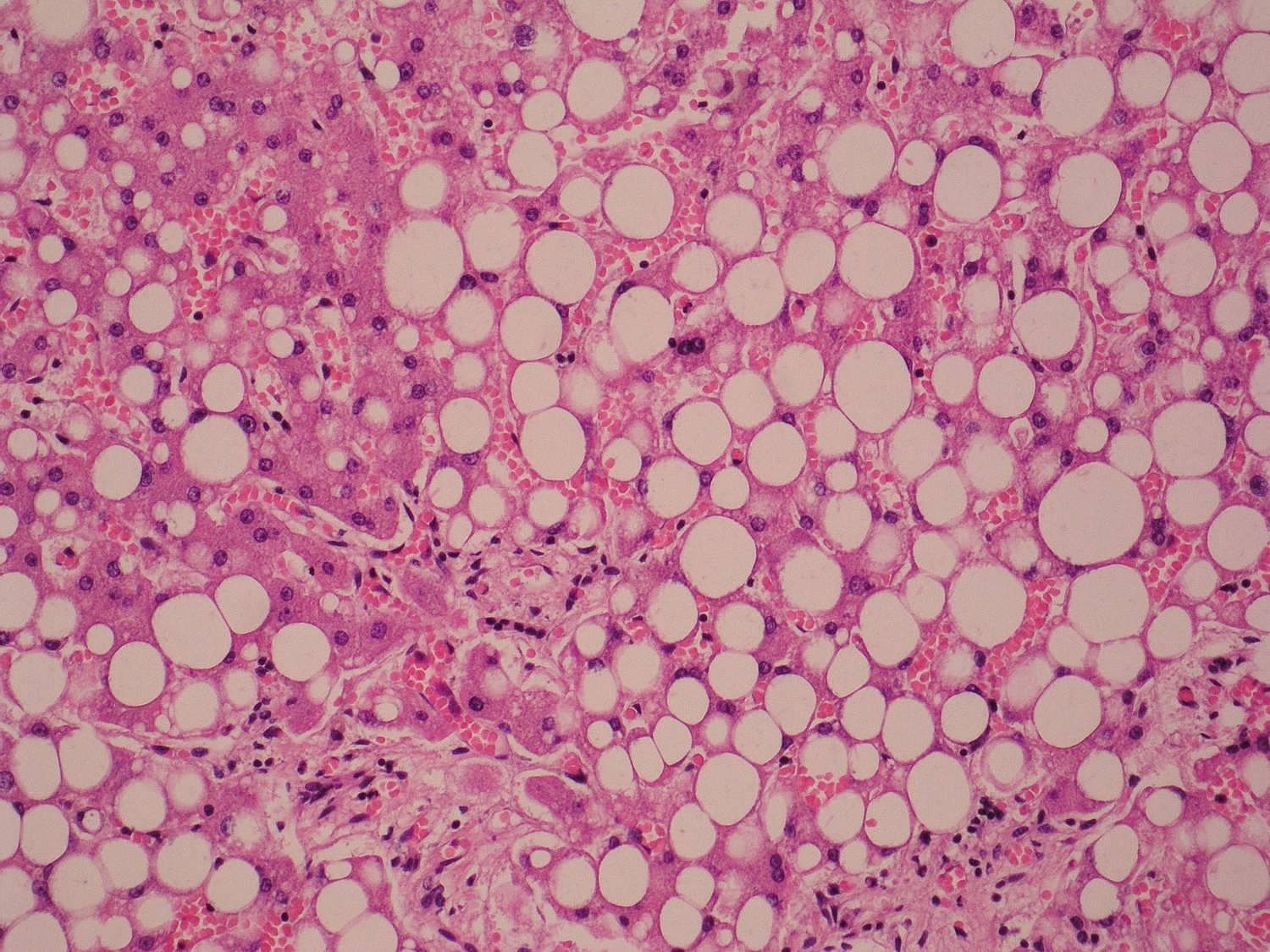 Microscopic view of adipose (fat) tissue.