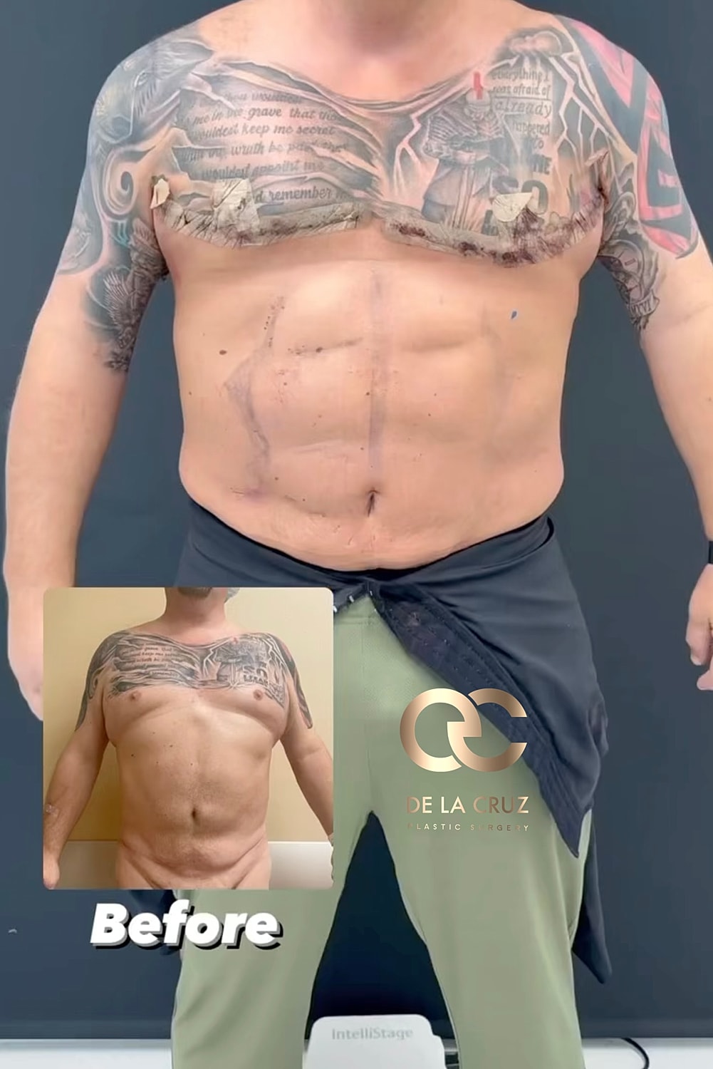 Post-surgery transformation with before and after images.