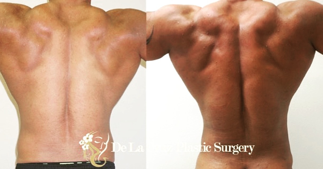 Before and after back transformation comparison.