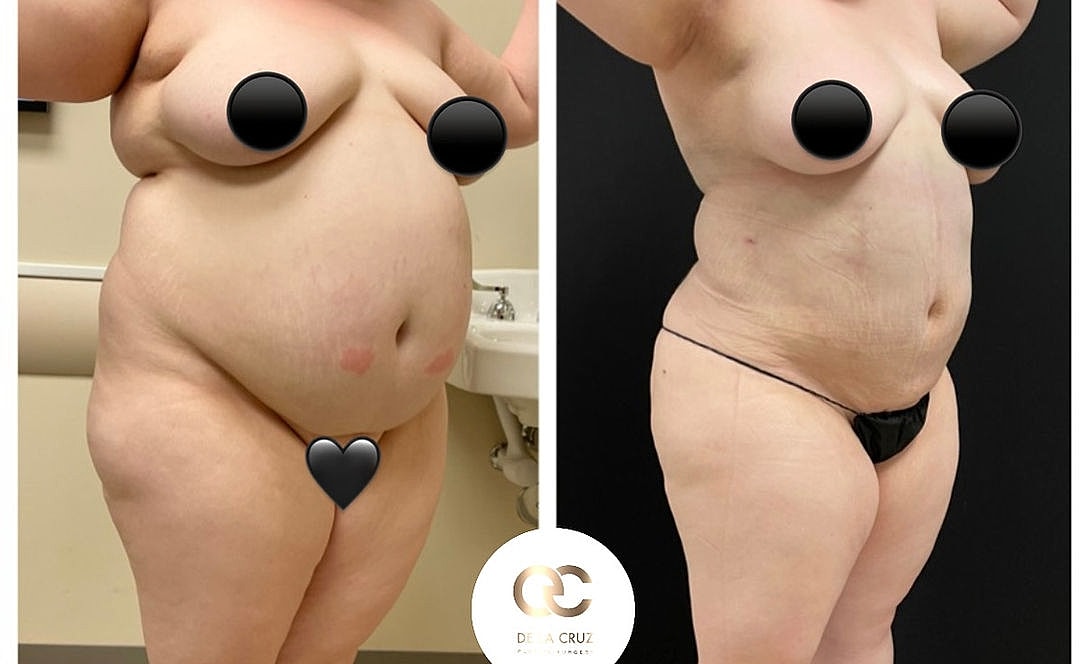 Before and after body transformation comparison.