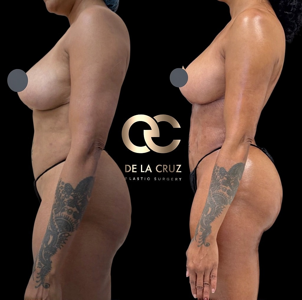 Before and after body transformation photo.