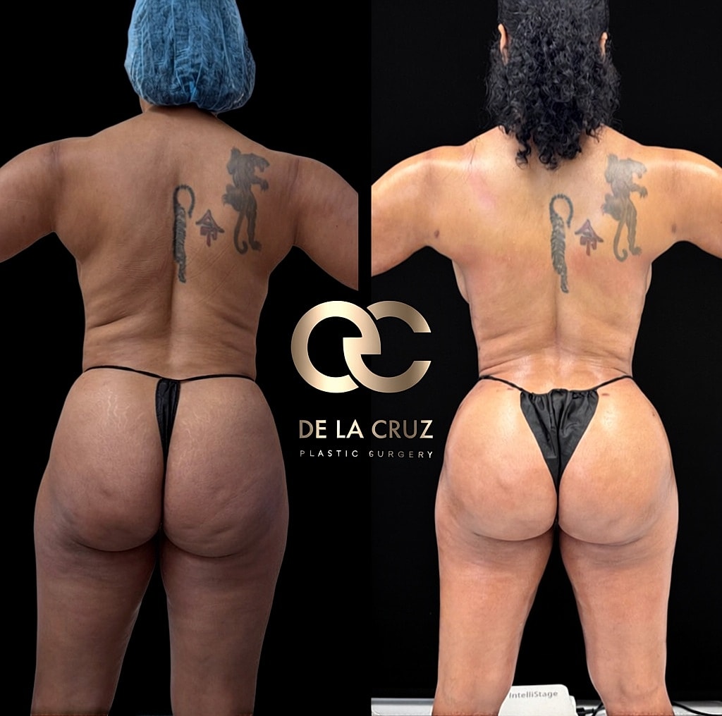 Before and after plastic surgery transformation.