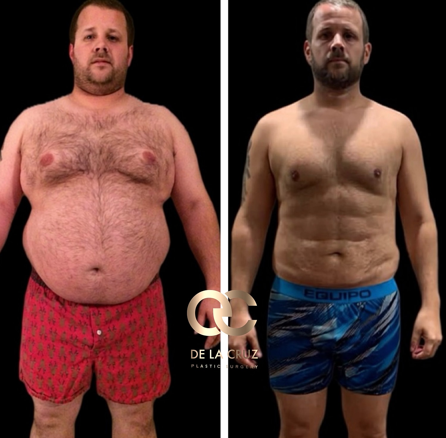 Before and after weight loss transformation image.