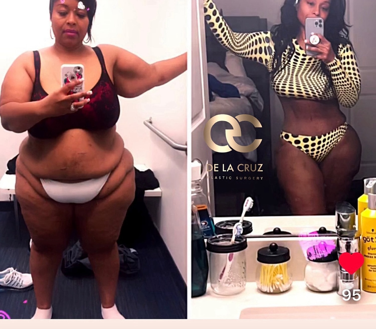 Before and after transformation photos of a woman