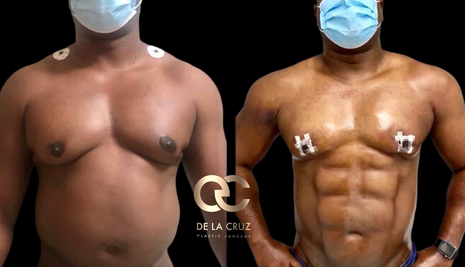Before and after body transformation comparison.