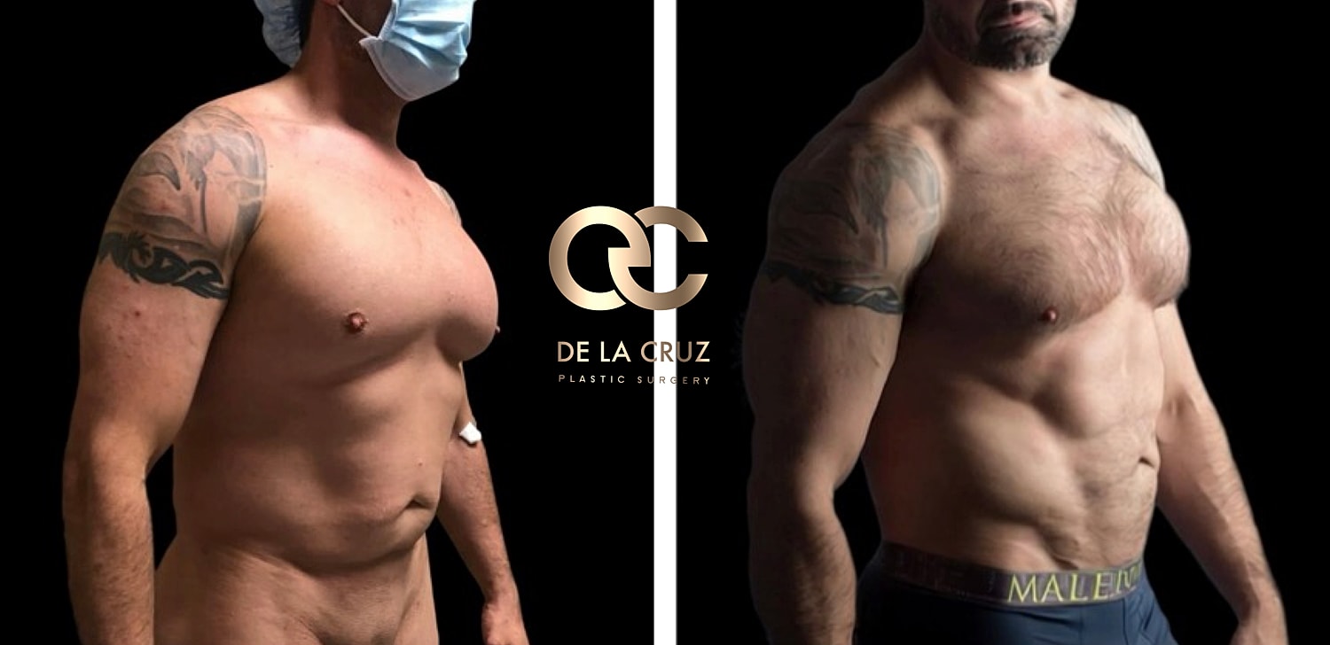 Before and after male body transformation.