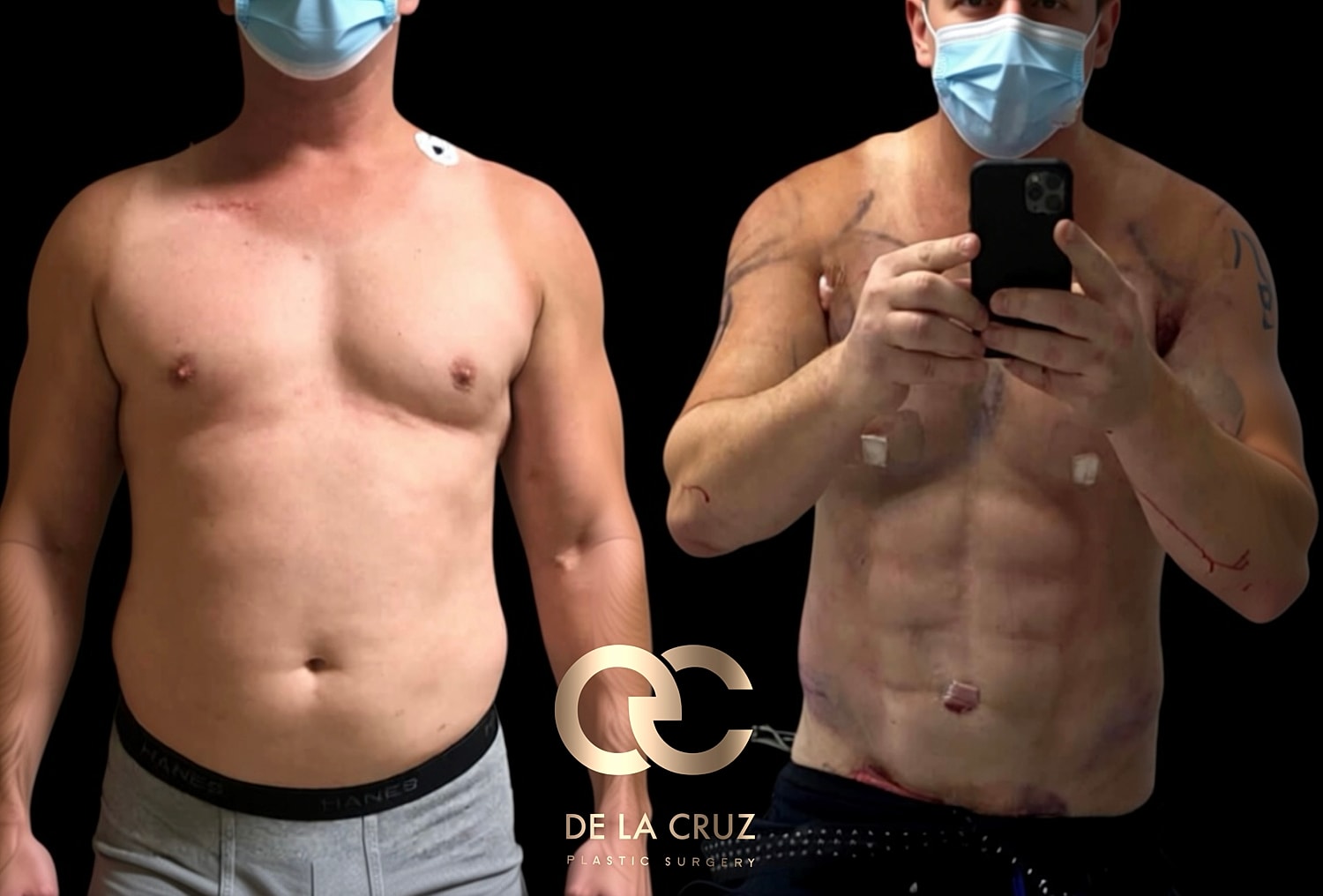 Before and after plastic surgery transformation.