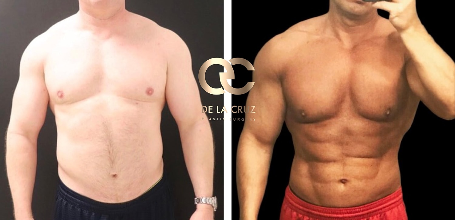 Before and after body transformation photos.