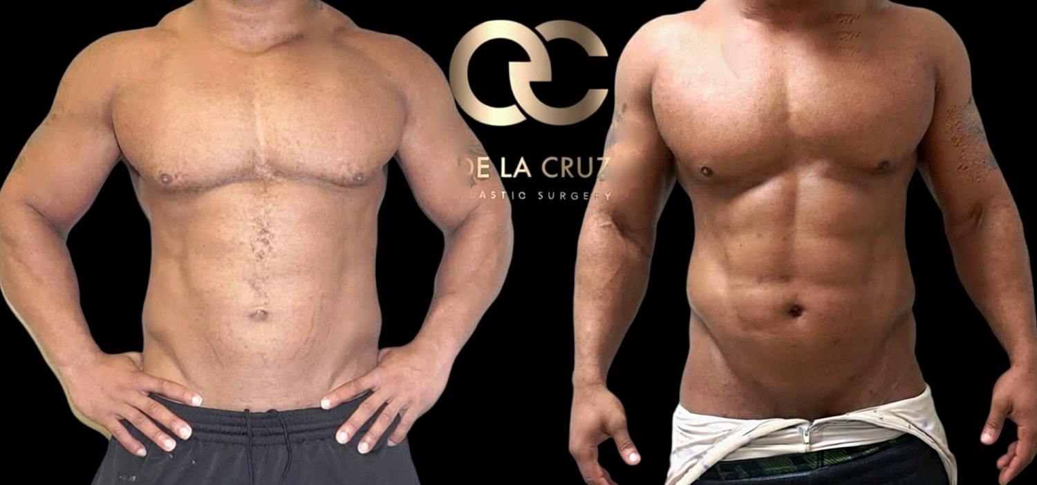 Before and after photos of body transformation.