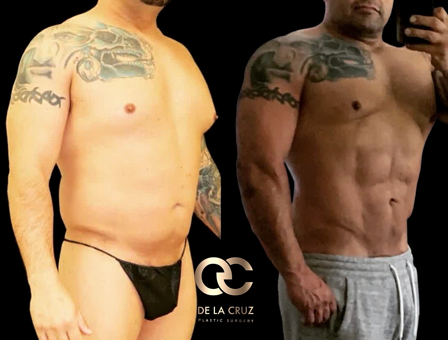 Before and after body transformation comparison.