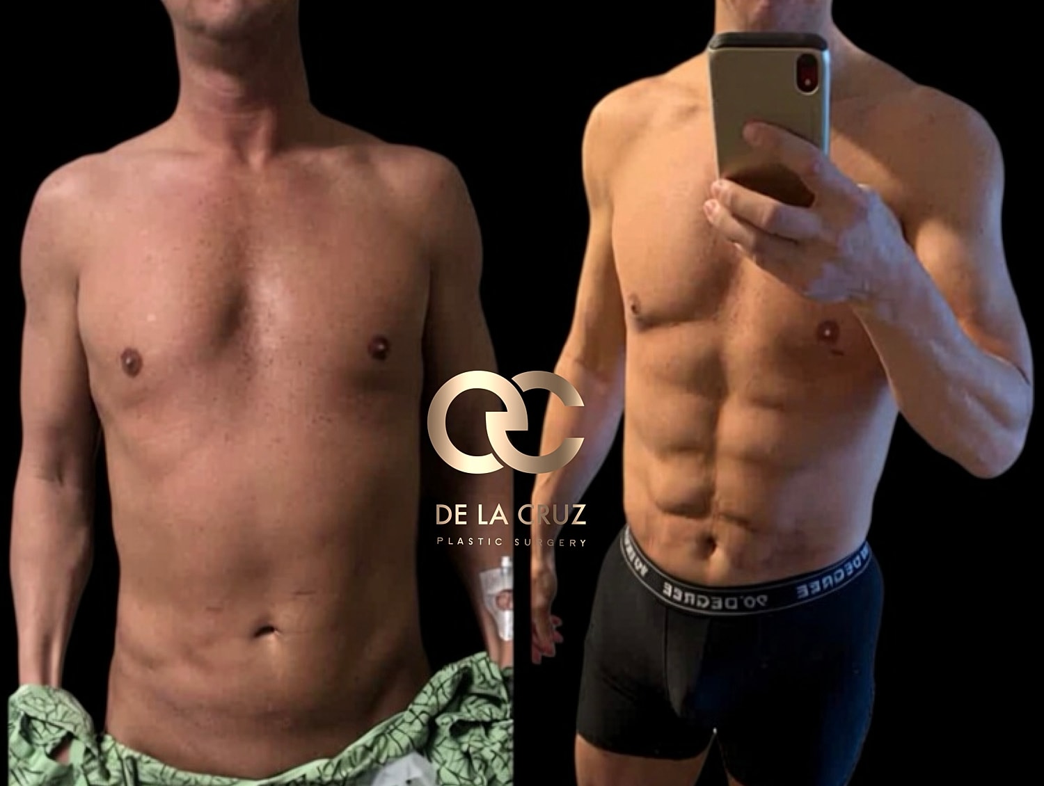 Before and after plastic surgery transformation.