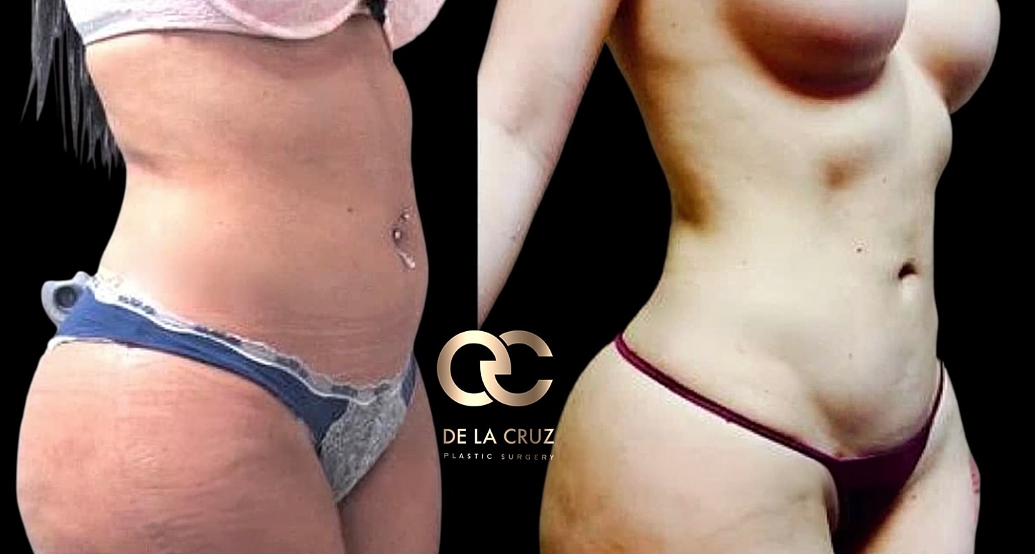 Before and after body transformation comparison image.